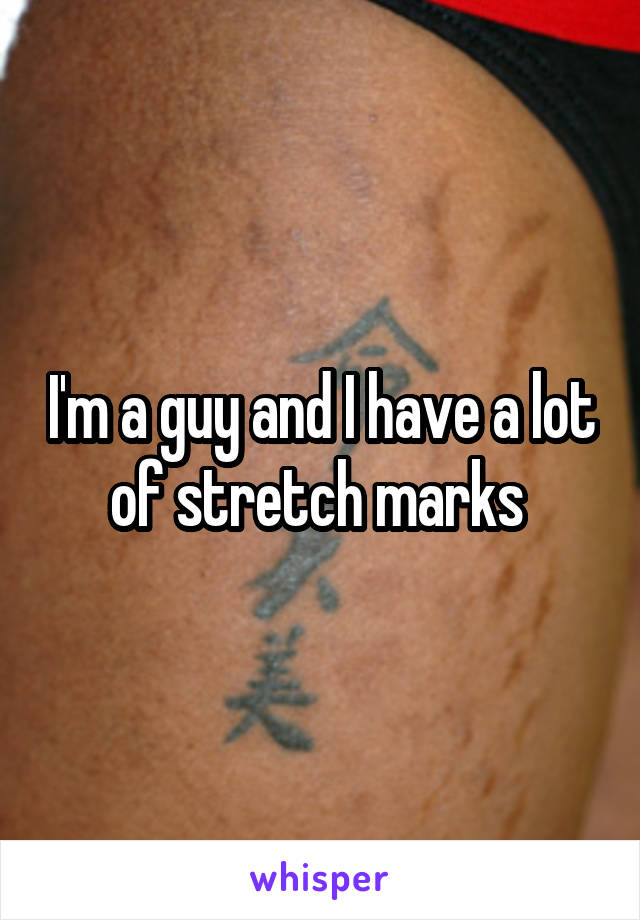 I'm a guy and I have a lot of stretch marks 