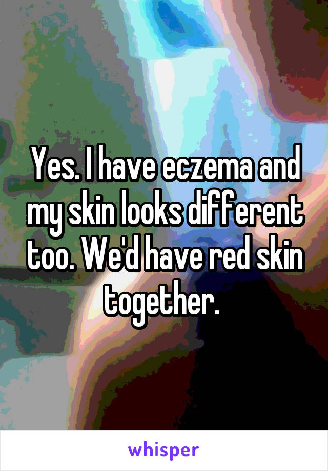 Yes. I have eczema and my skin looks different too. We'd have red skin together. 