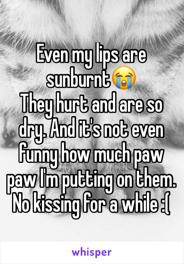 Even my lips are sunburnt😭
They hurt and are so dry. And it's not even funny how much paw paw I'm putting on them.
No kissing for a while :(