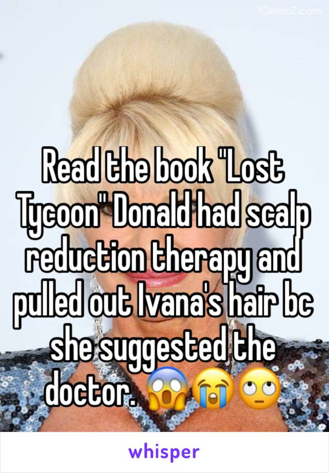 Read the book "Lost Tycoon" Donald had scalp reduction therapy and pulled out Ivana's hair bc she suggested the doctor. 😱😭🙄