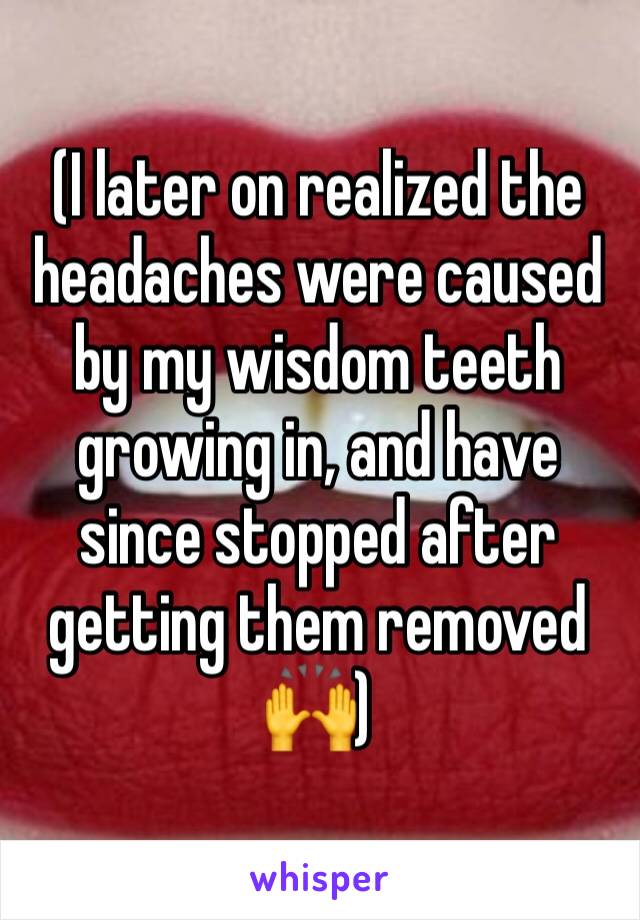 (I later on realized the headaches were caused by my wisdom teeth growing in, and have since stopped after getting them removed 🙌)