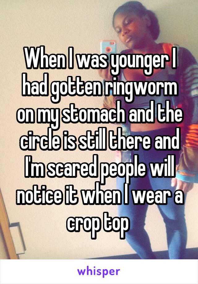 When I was younger I had gotten ringworm on my stomach and the circle is still there and I'm scared people will notice it when I wear a crop top 