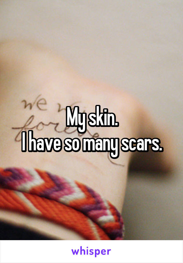 My skin.
I have so many scars.