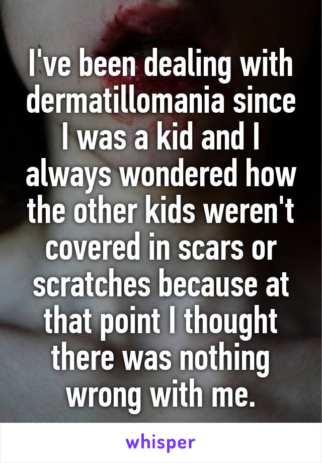 I've been dealing with dermatillomania since I was a kid and I always wondered how the other kids weren't covered in scars or scratches because at that point I thought there was nothing wrong with me.