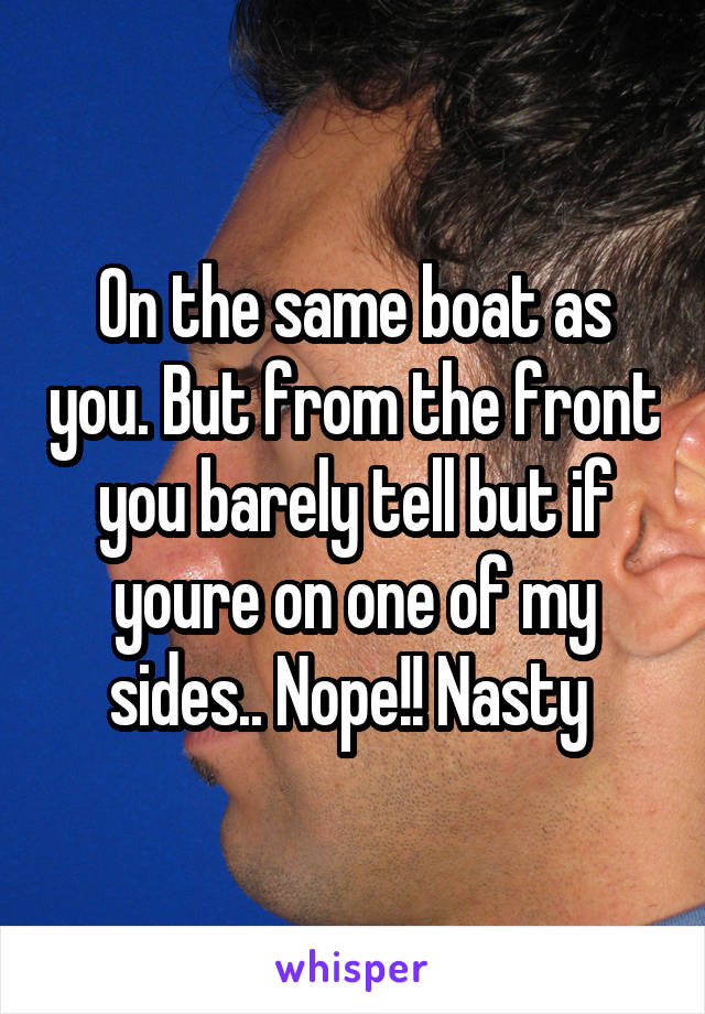 On the same boat as you. But from the front you barely tell but if youre on one of my sides.. Nope!! Nasty 