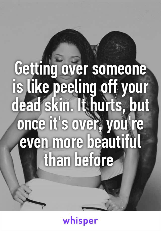 Getting over someone is like peeling off your dead skin. It hurts, but once it's over, you're even more beautiful than before 