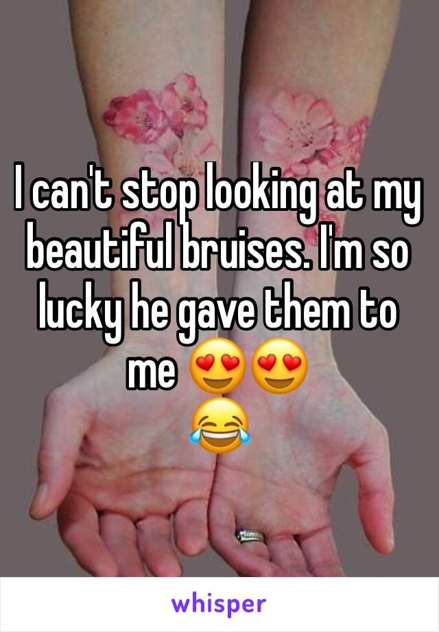 I can't stop looking at my beautiful bruises. I'm so lucky he gave them to me 😍😍 
😂