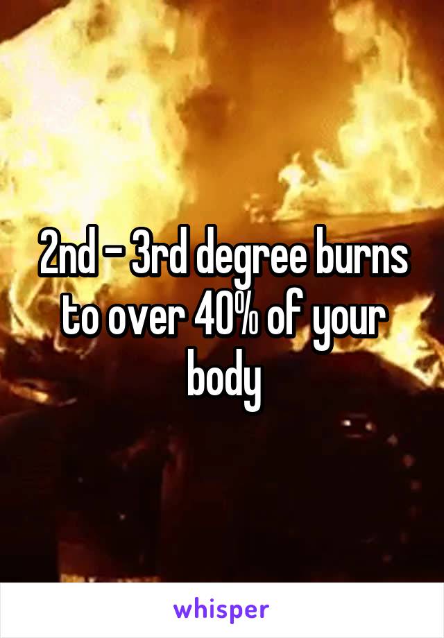 2nd - 3rd degree burns to over 40% of your body