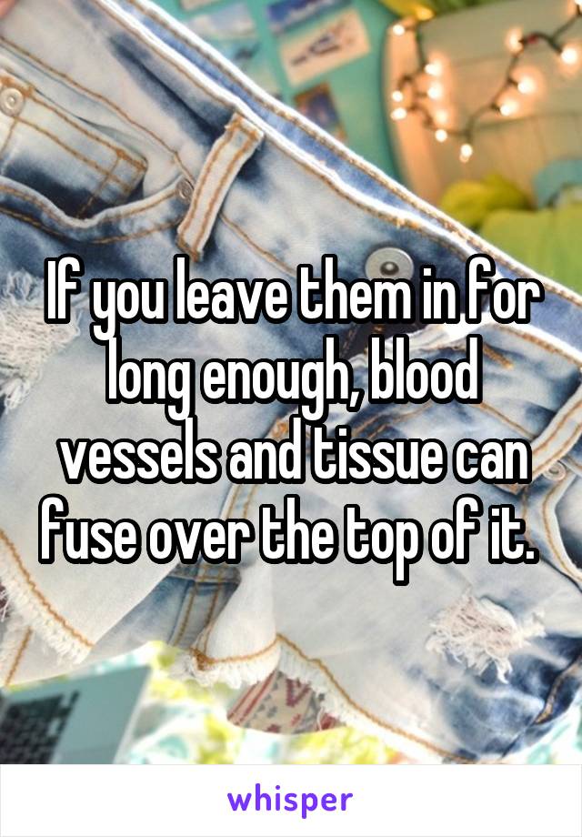 If you leave them in for long enough, blood vessels and tissue can fuse over the top of it. 