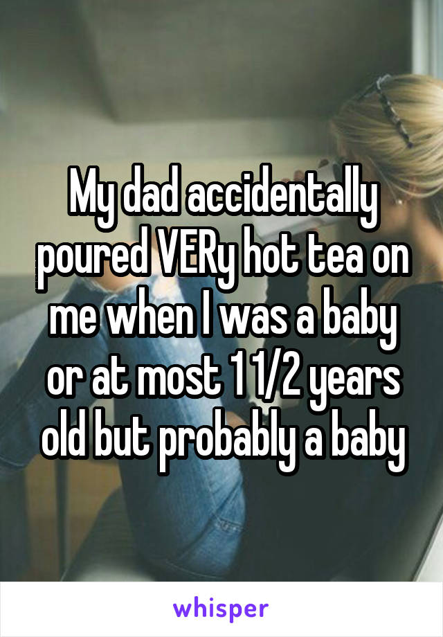 My dad accidentally poured VERy hot tea on me when I was a baby or at most 1 1/2 years old but probably a baby