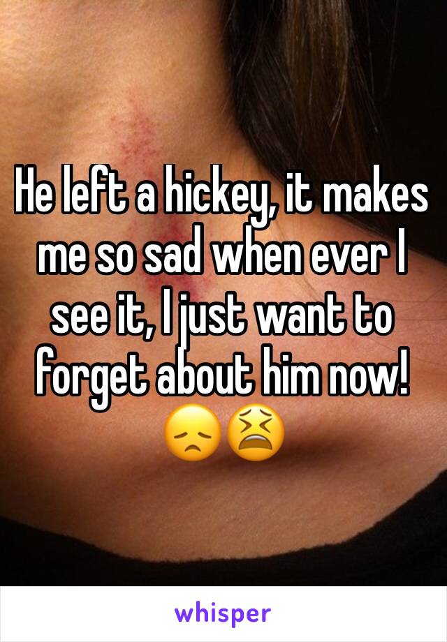 He left a hickey, it makes me so sad when ever I see it, I just want to forget about him now!😞😫