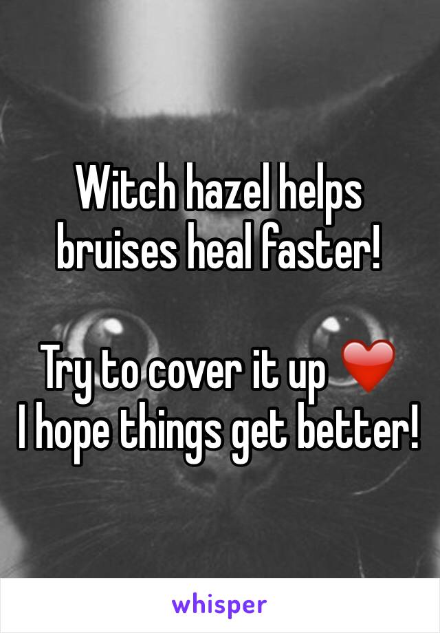 Witch hazel helps bruises heal faster!

Try to cover it up ❤️
I hope things get better!