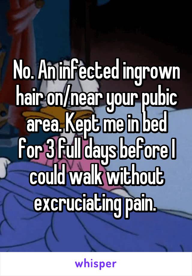 No. An infected ingrown hair on/near your pubic area. Kept me in bed for 3 full days before I could walk without excruciating pain. 