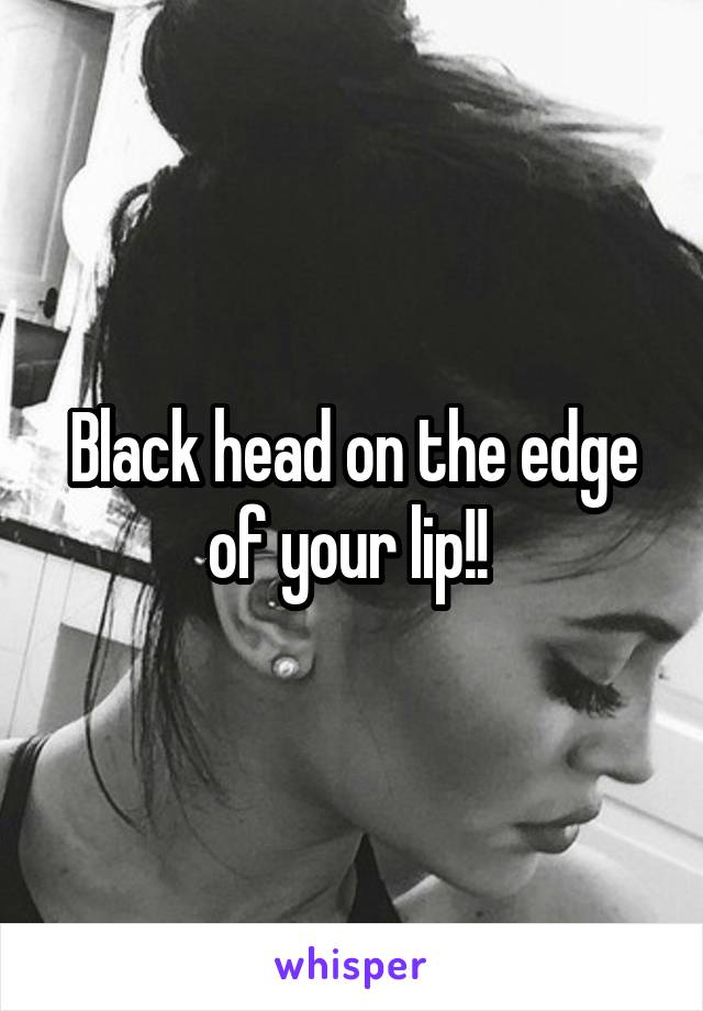 Black head on the edge of your lip!! 