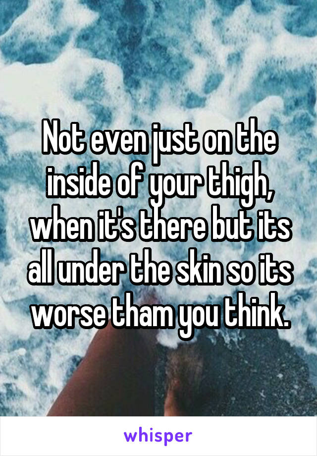 Not even just on the inside of your thigh, when it's there but its all under the skin so its worse tham you think.