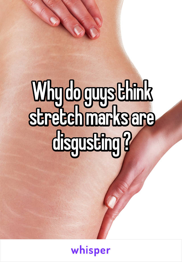 Why do guys think stretch marks are disgusting ?
