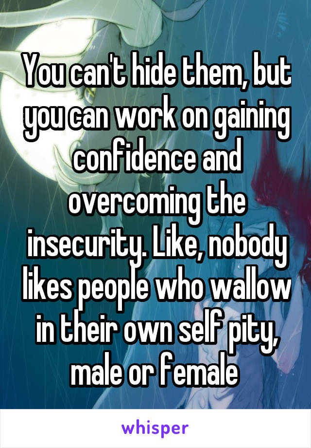 You can't hide them, but you can work on gaining confidence and overcoming the insecurity. Like, nobody likes people who wallow in their own self pity, male or female 