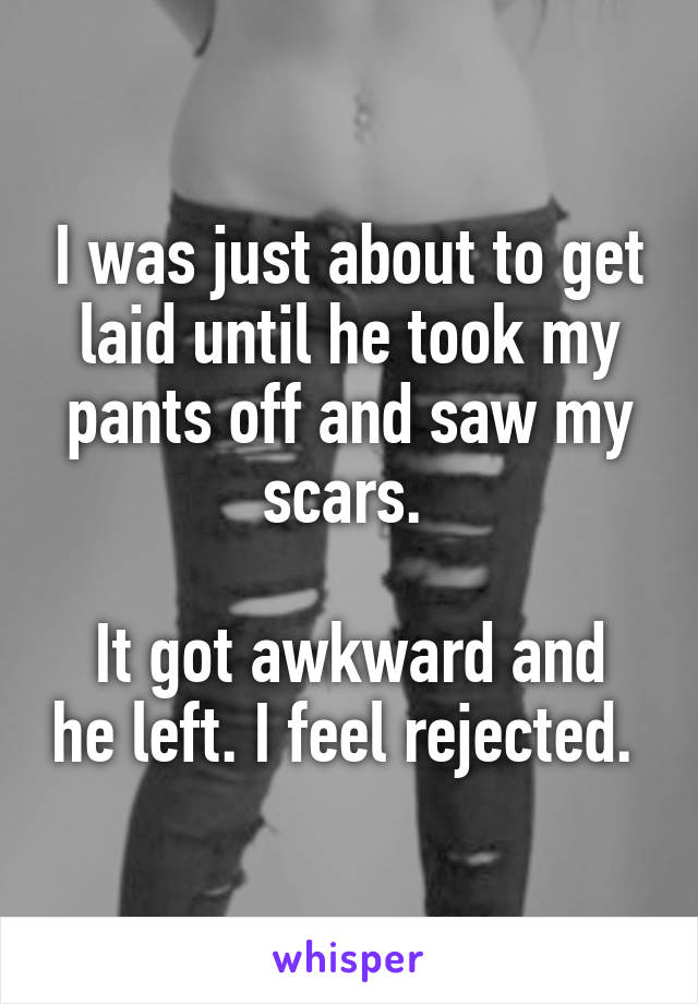 I was just about to get laid until he took my pants off and saw my scars. 

It got awkward and he left. I feel rejected. 