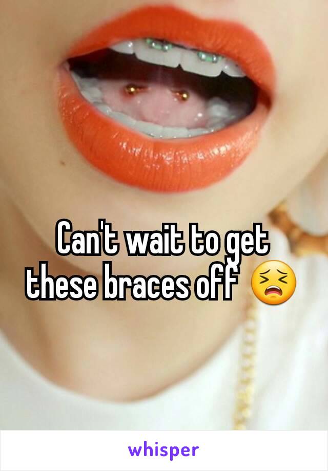 Can't wait to get these braces off 😣