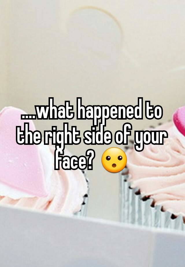 what-happened-to-the-right-side-of-your-face