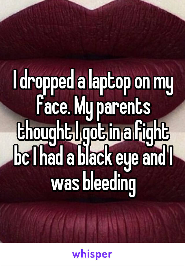 I dropped a laptop on my face. My parents thought I got in a fight bc I had a black eye and I was bleeding