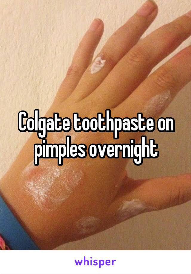 colgate-toothpaste-on-pimples-overnight