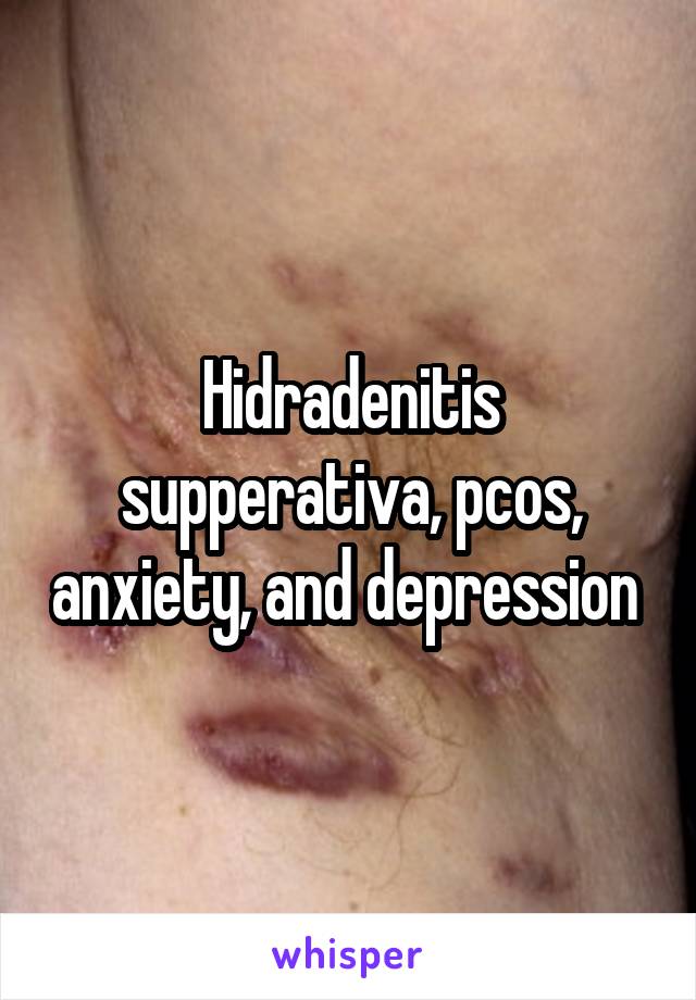 Hidradenitis supperativa, pcos, anxiety, and depression 