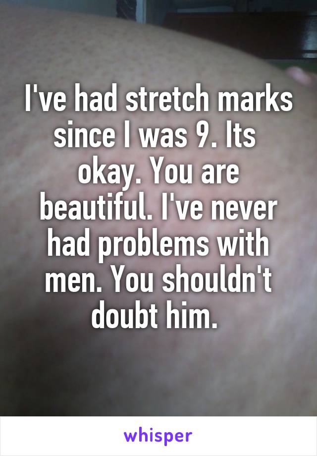 I've had stretch marks since I was 9. Its  okay. You are beautiful. I've never had problems with men. You shouldn't doubt him. 
