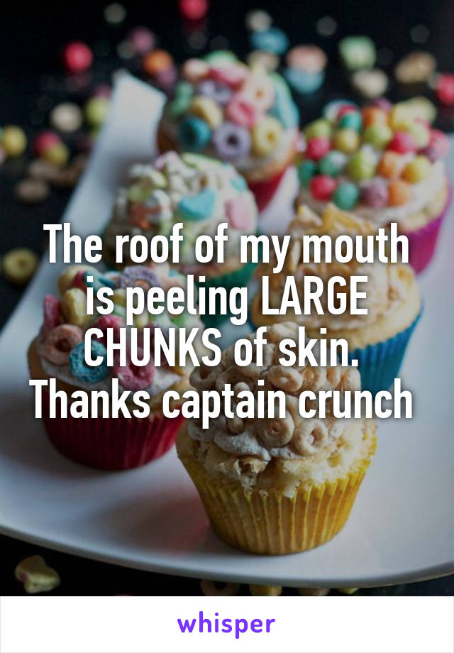 The roof of my mouth is peeling LARGE CHUNKS of skin.  Thanks captain crunch 