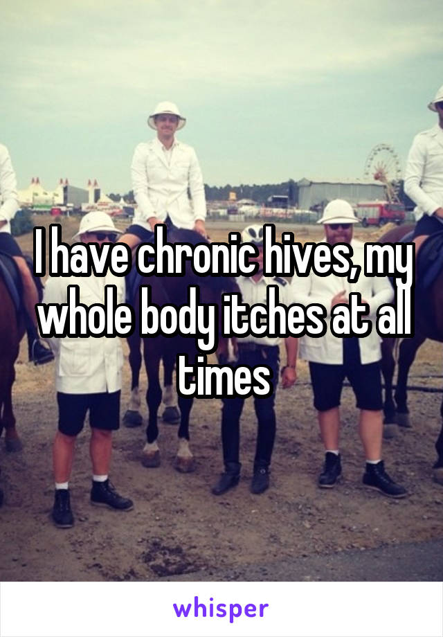 I have chronic hives, my whole body itches at all times