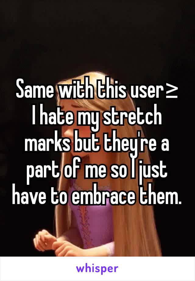 Same with this user≥
I hate my stretch marks but they're a part of me so I just have to embrace them.