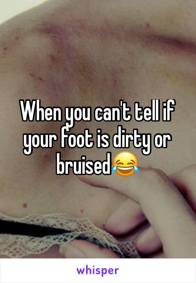 When you can't tell if your foot is dirty or bruised😂