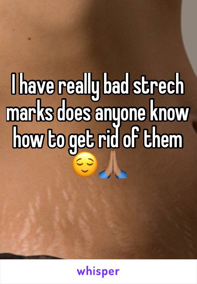 I have really bad strech marks does anyone know how to get rid of them
😌🙏🏽