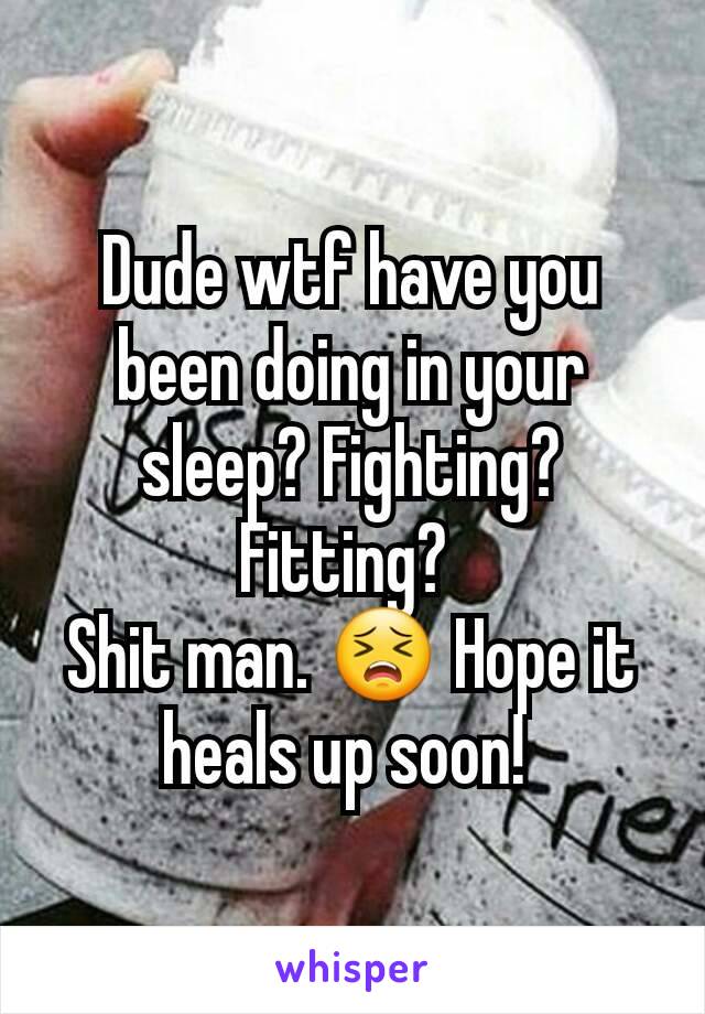 Dude wtf have you been doing in your sleep? Fighting? Fitting? 
Shit man. 😣 Hope it heals up soon! 