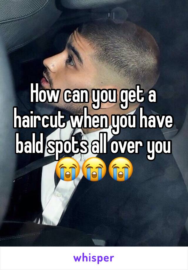 How can you get a haircut when you have bald spots all over you 😭😭😭
