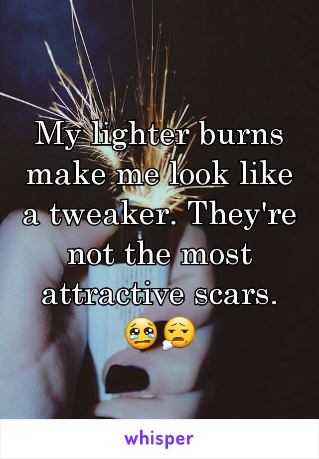 My lighter burns make me look like a tweaker. They're not the most attractive scars. 😢😧