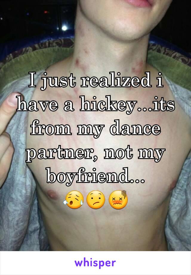 I just realized i have a hickey...its from my dance partner, not my boyfriend...
😥😕😖