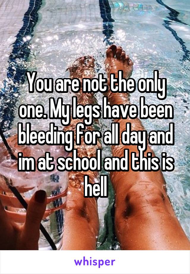 You are not the only one. My legs have been bleeding for all day and im at school and this is hell