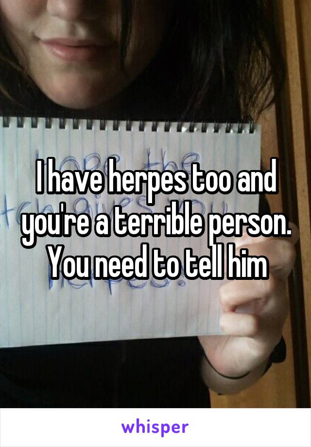 I have herpes too and you're a terrible person. You need to tell him