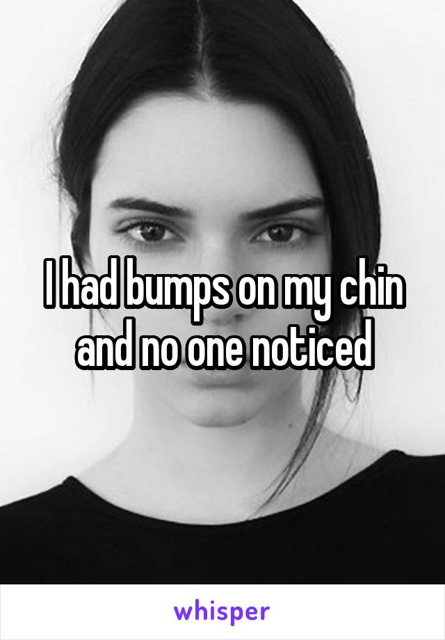 I had bumps on my chin and no one noticed