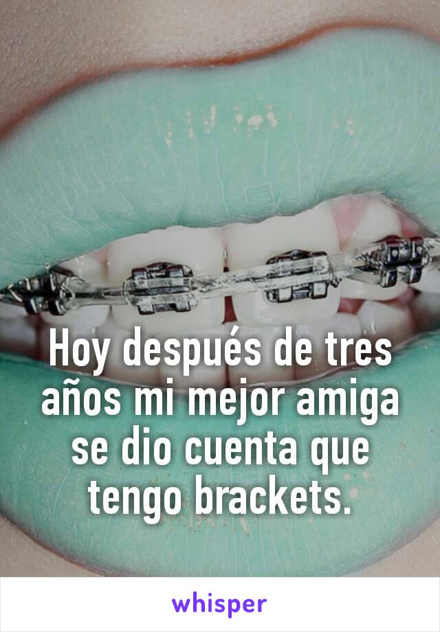 Hoy después de tres años mi mejor amiga se dio cuenta que tengo brackets.