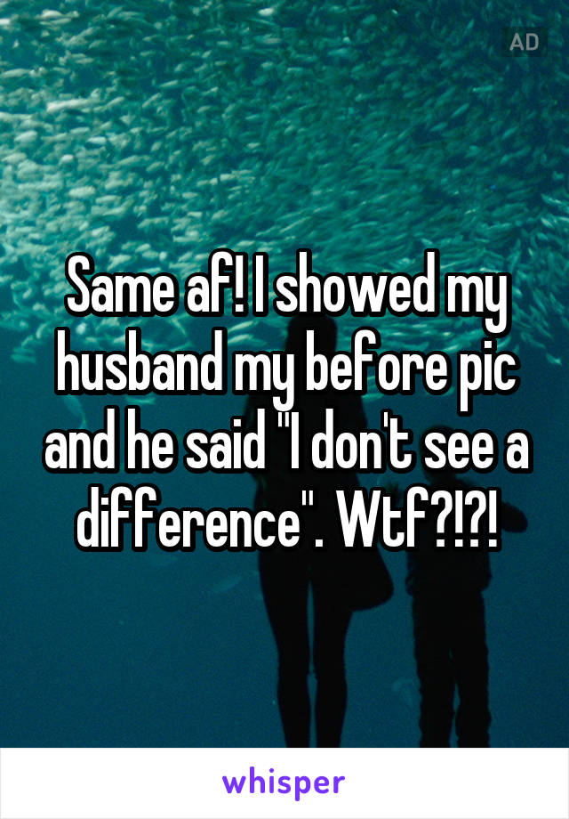 Same af! I showed my husband my before pic and he said "I don't see a difference". Wtf?!?!