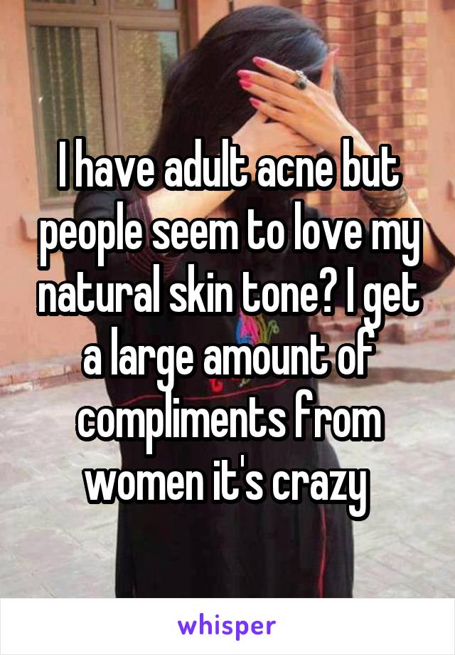 I have adult acne but people seem to love my natural skin tone? I get a large amount of compliments from women it's crazy 