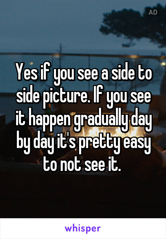Yes if you see a side to side picture. If you see it happen gradually day by day it's pretty easy to not see it. 