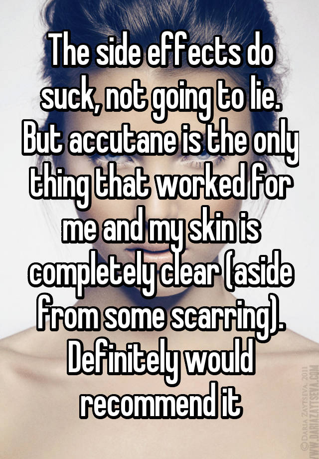 The Side Effects Do Suck Not Going To Lie But Accutane Is The Only