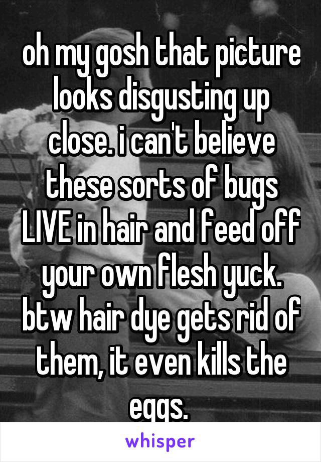 oh my gosh that picture looks disgusting up close. i can't believe these sorts of bugs LIVE in hair and feed off your own flesh yuck. btw hair dye gets rid of them, it even kills the eggs. 