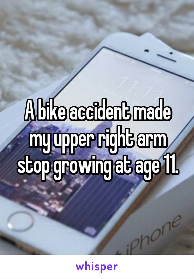 A bike accident made my upper right arm stop growing at age 11.