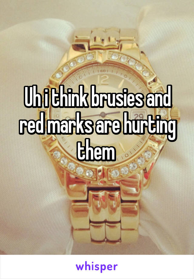 Uh i think brusies and red marks are hurting them 
