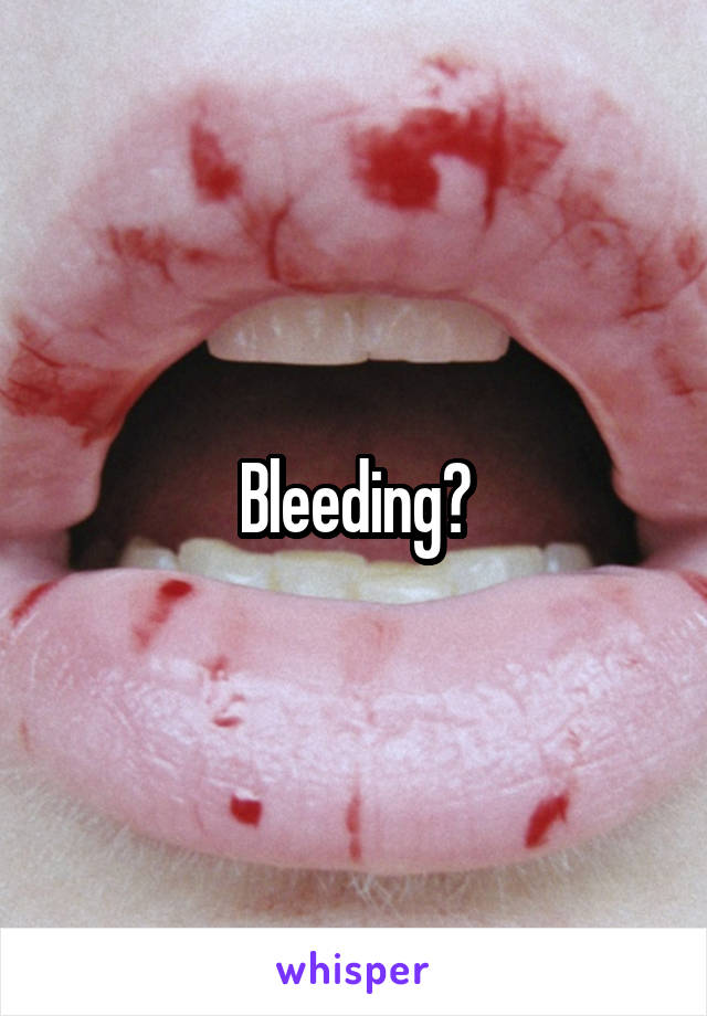 Bleeding?