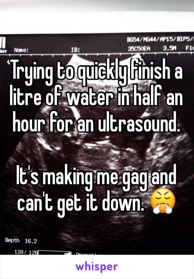 Trying to quickly finish a litre of water in half an hour for an ultrasound. 

It's making me gag and can't get it down. 😤